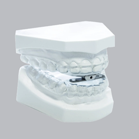 Anti Snoring Device Nottingham
